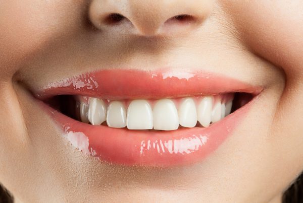 white teeth from oil pulling